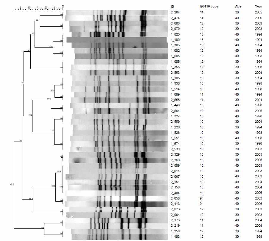 30-49세 연령대에서 분리한 16개의 IS6110-RFLP cluster