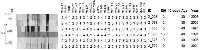 30-49세 연령대에서 분리한 3개의 IS6110-RFLP 및 MIRU-VNTR cluster