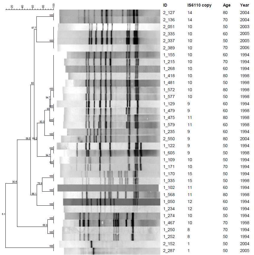 50세이상 연령대에서 분리한 17개의 IS6110-RFLP cluster