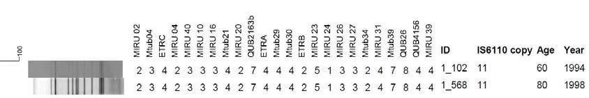 50세이상 연령대에서 분리한 1개의 IS6110-RFLP 및 MIRU-VNTR cluster
