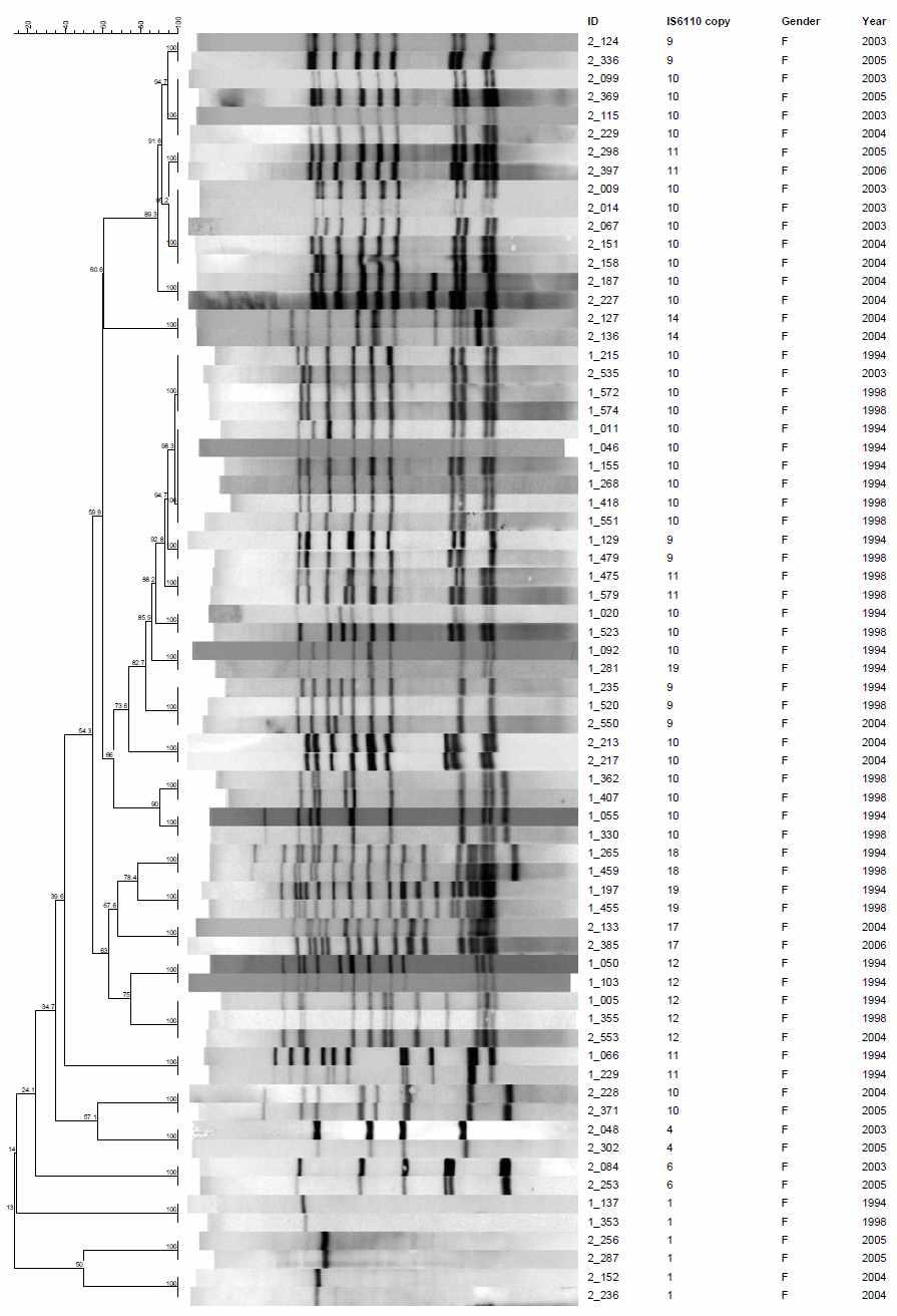 여성으로부터 분리한 28개의 IS6110-RFLP cluster