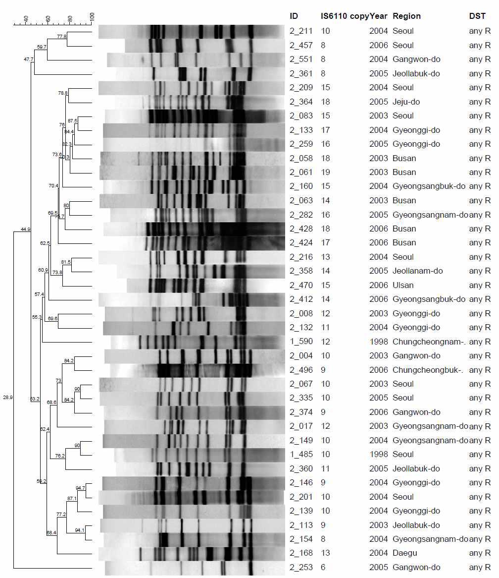 Any R 대상균주 IS6110-RFLP pattern