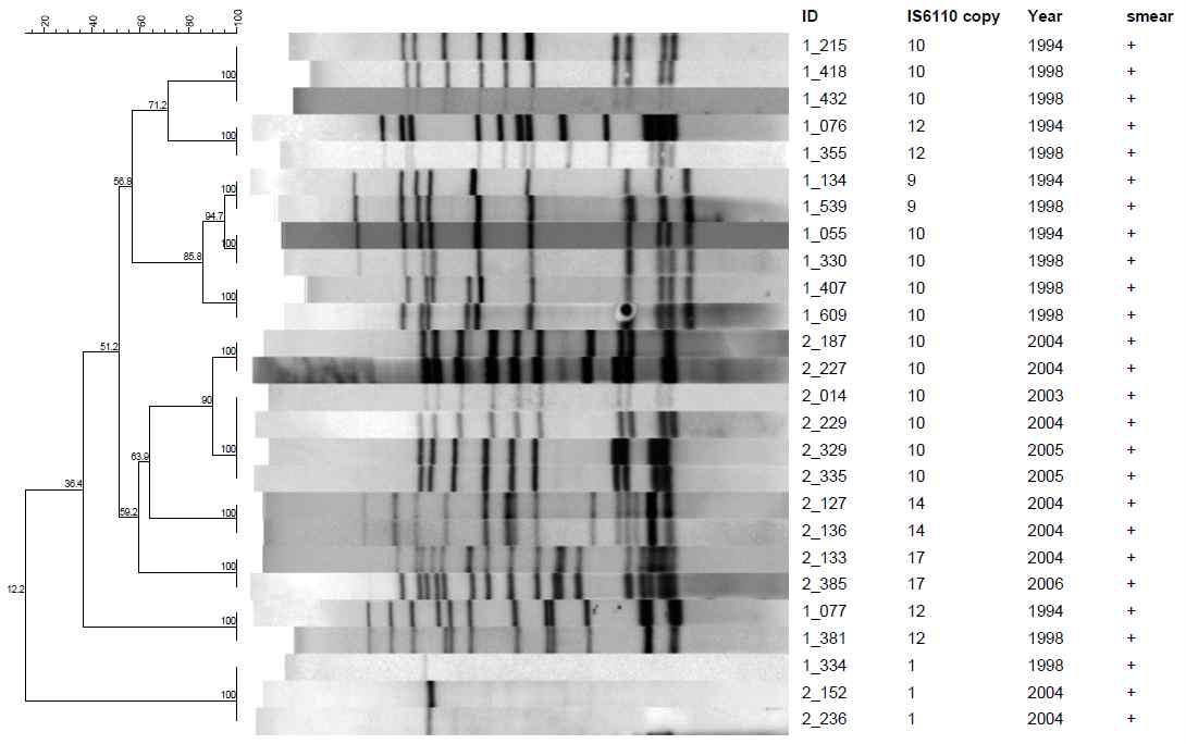 도말검사등급 1 Positive (+)로부터 11개의 IS6110-RFLP cluster