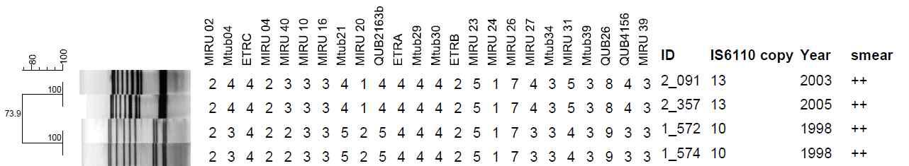 도말검사등급 2 Positive (++)로부터 2개의 IS6110-RFLP 및 MIRU-VNTR cluster