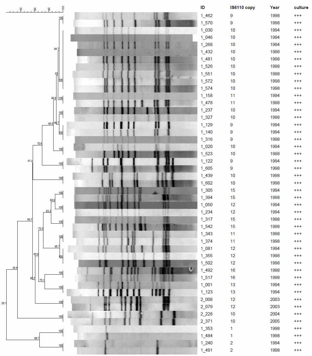 배양검사등급 3 Positive (+++)로부터 19개의 IS6110-RFLP cluster