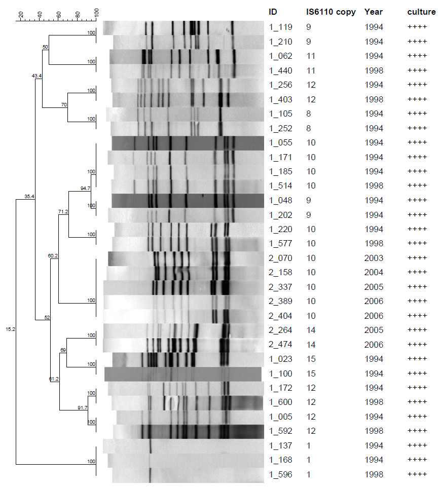 배양검사등급 4 Positive (++++)로부터 13개의 IS6110-RFLP cluster