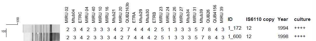 배양검사등급 4 Positive (++++)로부터 1개의 IS6110-RFLP 및 MIRU-VNTR cluster