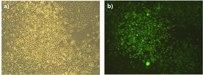 SiHa 세포주에 GFP transfection. a) visible light에서 관찰 b) 395/475 nm light에서 관찰