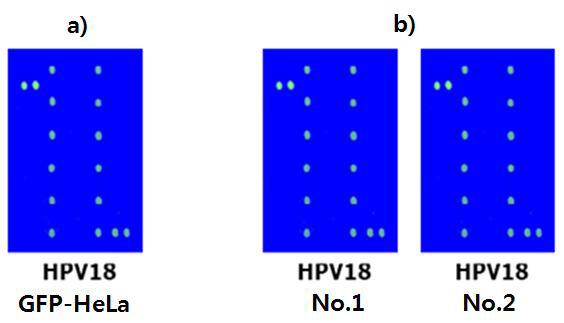 GFP-HeLa 세포와 orthotopic xenograft model에서 적출한 종괴의 HPV-typing 비교