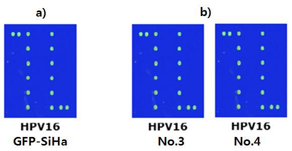 GFP-SiHa 세포와 orthotopic xenograft model에서 적출한 종괴의 HPV-typing 비교