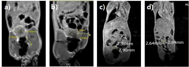 자궁경부암 조직을 이식한 PDOX 모델의 암종괴 성장 확인(MRI 촬영 )