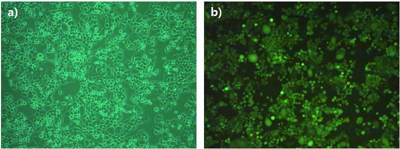 HeLa 세포주에 GFP transfection. a) visible light에서 관찰 b) 395/475 nm light에서 관찰