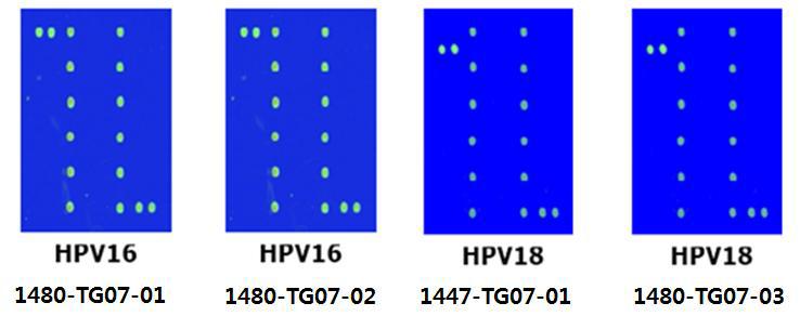 자궁경부암 조직의 HPV-typing 결과(2차년도 이식).