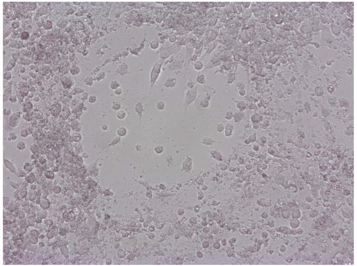 마우스 비장세포 접종 후 마우스 L세포에서 관찰된 세포병변효과(플라크)