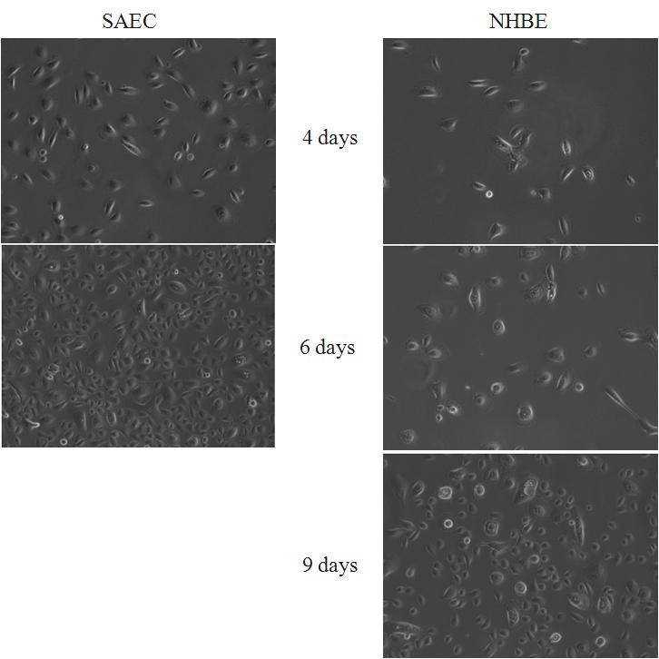 각 증식배지에서 자라는 미분화 SAEC와 NHBE 세포주(현미경, 100X 확대)