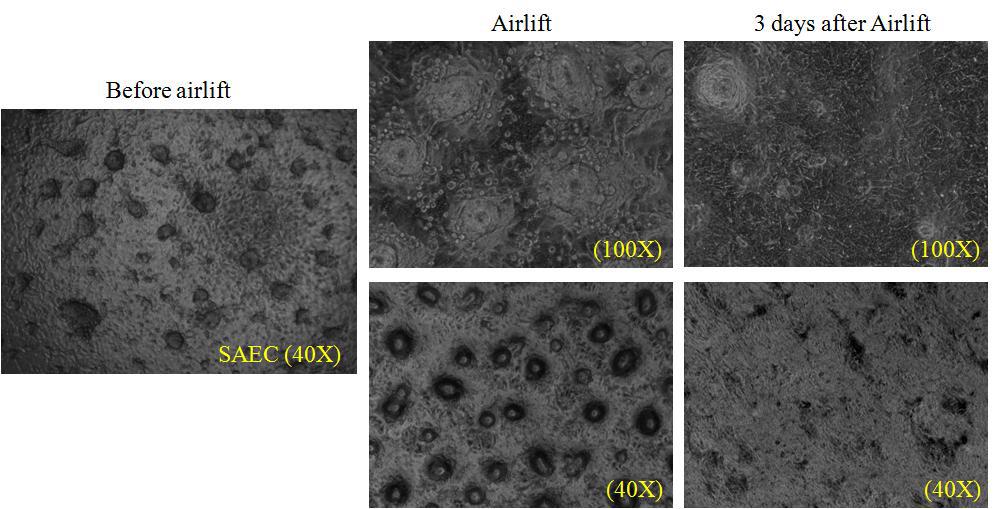 SAEC 상피 세포들이 분화 유도되는 과정.