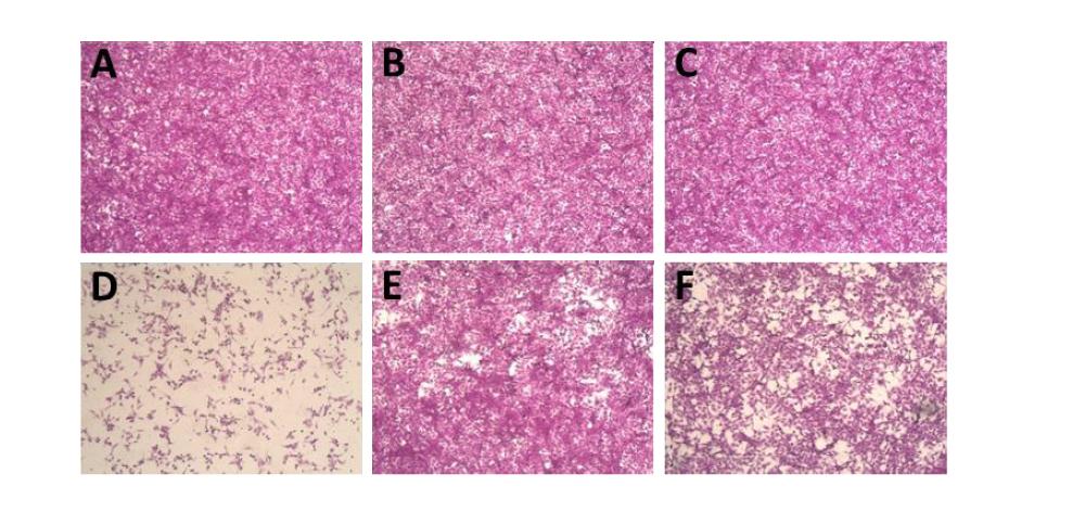 Effect of corilagin on CVA16–induced cytotoxicity.