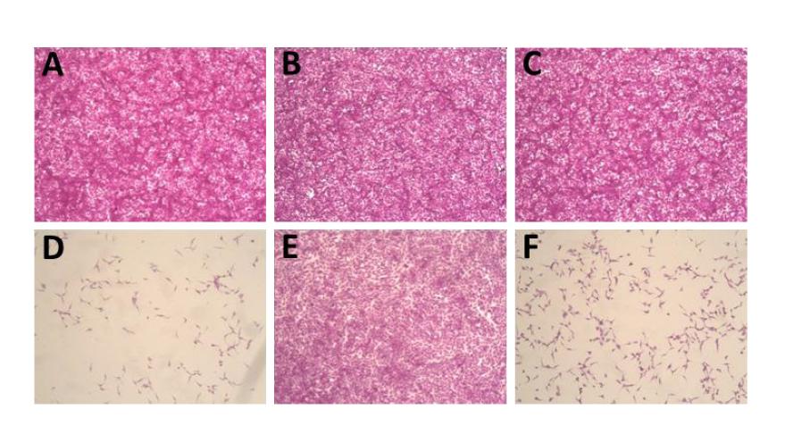 Effect of corilagin on EV71–induced cytotoxicity.