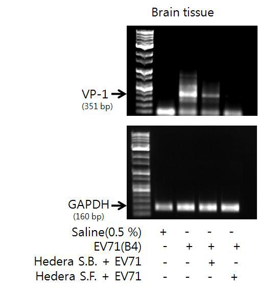 Hedera saponin B, Hedera saponin F의 복강투여가 EV71(B4)를 뇌내 감염시킨 Nenate mouse에서 유도된 VP-1유전자에 미치는 영향