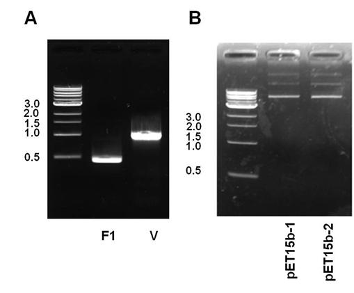 PCR을 통한 페스트 F1 및 V 항원 유전자 증폭 및 확인