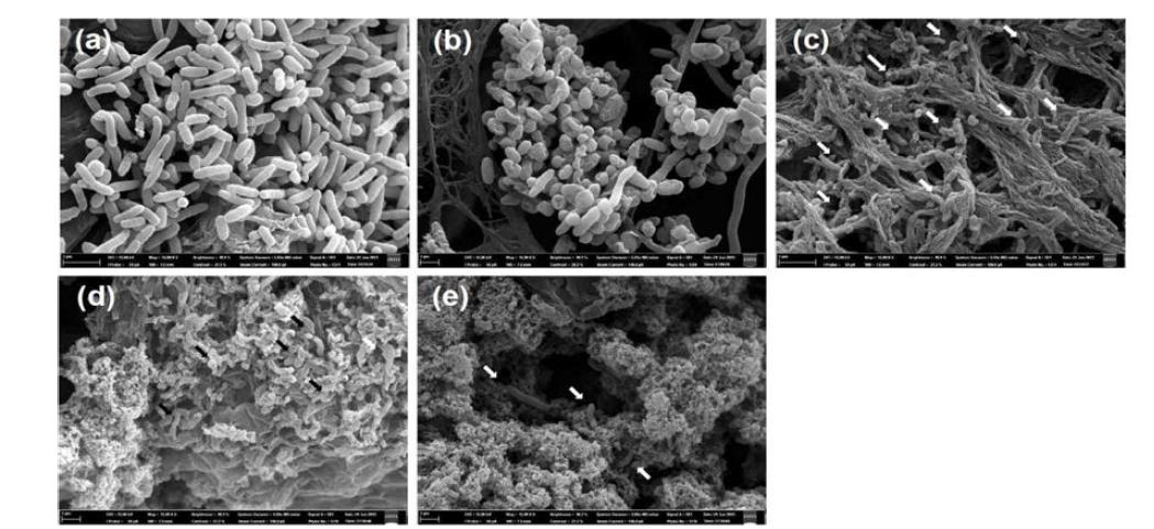 V. parahaemolyticus NCCP11143의 동결건조 SEM 이미지