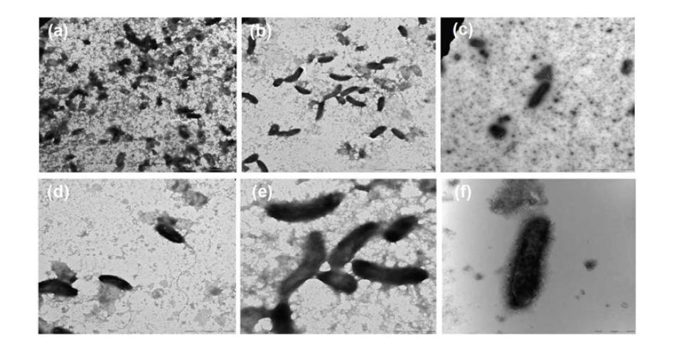 V. cholerae NCCP14550의 보존제별 동결건조 후 TEM 이미지