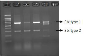 Verification of stx genes in E. coli strains by multiplex PCR with specific primer. lane 1, 100 bp ladder marker; lane 2, NCCP 15736; lane 3, NCCP 15737; lane 4, NCCP 15739; lane 5, Positive control; lane 6, Negative control