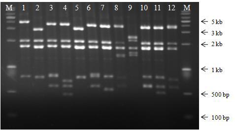 RFLP patterns of PCR products (one single primer set, vanZ-2) digested with the restriction enzyme ClaI in VRE carrying vanZ. M, 1-kb marker; lane 1, 12001, 12002; lane 2, 12005; lane 3, 12009, 12013, 12093, 12097, 12115, 12142, 12221, 12239, 12250; 12017, 12019, 12201, 12202; lane 5, 12018, 12020, 12021, 12022; lane 6, 12031; lane 7, 12024, 12025, 12055; lane 8, 12099; lane 9, 12178; lane 10, 12209; lane 11, 12226; lane 12, 12256.