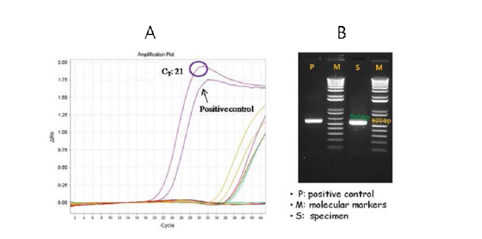 Detection of SFTS virus by real-time RT-PCR (A) and RT-PCR (B)