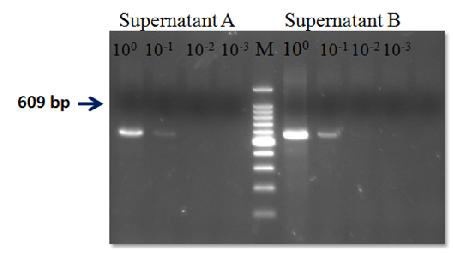 Detection of Epstain Bar virus from B95.8 cell culture supernatant