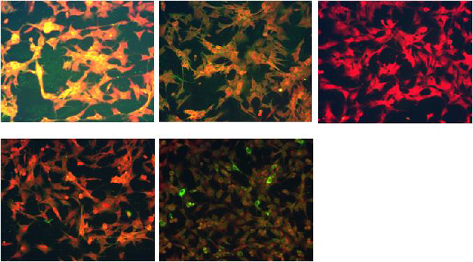 Immunoflorescent assay to detect antibodies binding to dengue virus