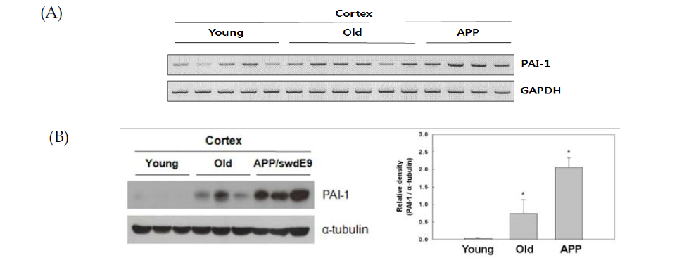 쥐의 Cortex에서 분리한 lysate를 (A) RT-PCR과 (B) Western blot 실험 기법을 이용하여 PAI-1의 발현 분석
