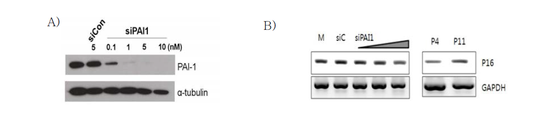 HUVEC에서 siPAI-1의 처리농도(A, B)에 따른 노화마커 P16 유전자(B) 발현 변화