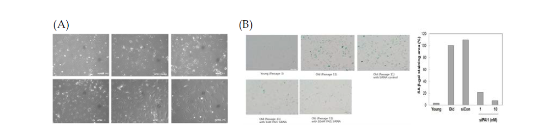 HUVEC에서 siPAI-1의 농도에 따른 형태의 변화(A)와 세포 노화의 지표가 되는 Senescence β-galactosidase staining(B)을 통한 염색 정도의 변화
