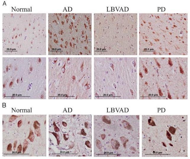 Nrf2 localization in several neurodegenerative diseases; Ramsey C.P., et al., J Neuropathol Exp Neurol, 2007〉