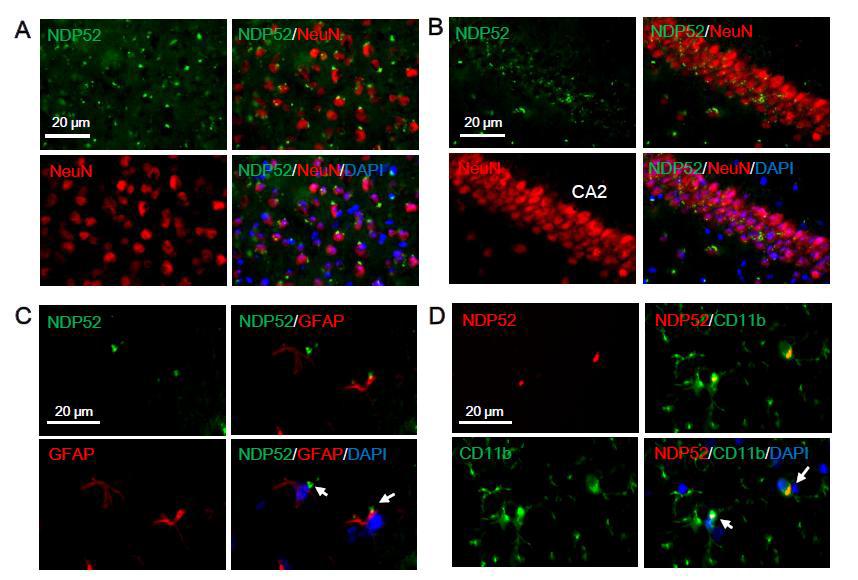 NDP52 is present in glial cells as well as neurons