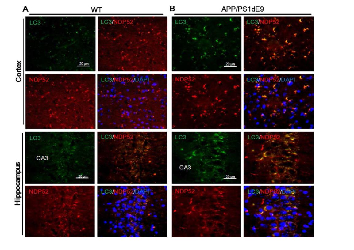 NDP52 co-localizes with LC3 in brains