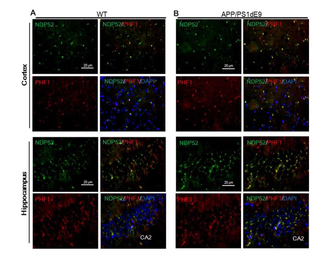 NDP52 associates with phosphorylated tau in brains