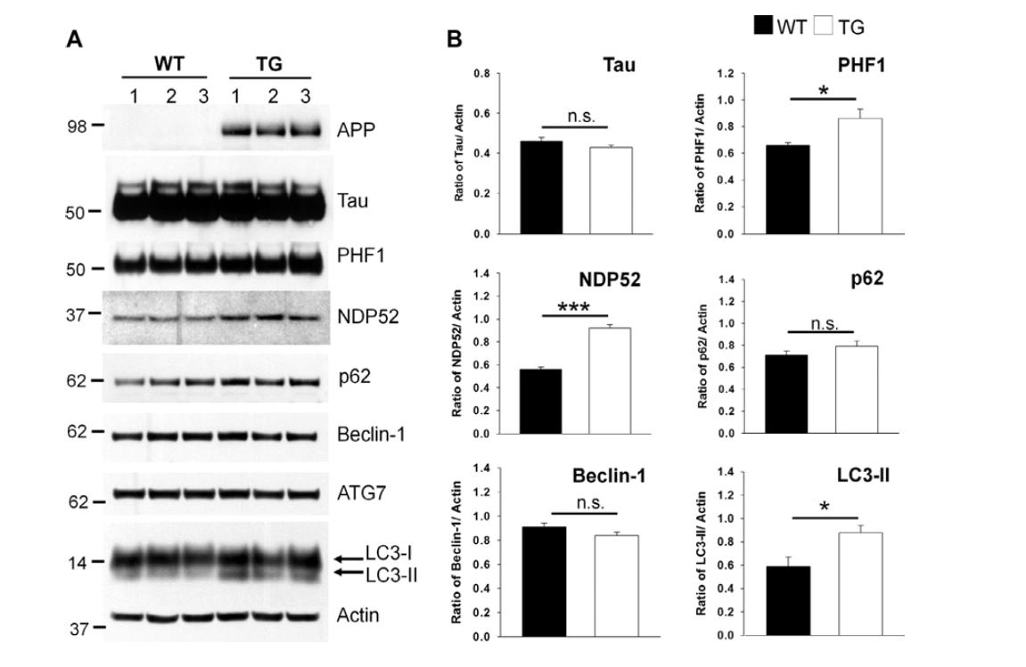 NDP52 is accumulated together with phosphorylated tau in the brains of TG mice