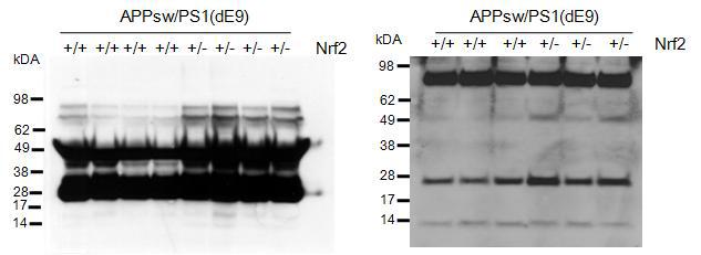 Comparison of 6E10-specific bands in sera and hippocampal extracts