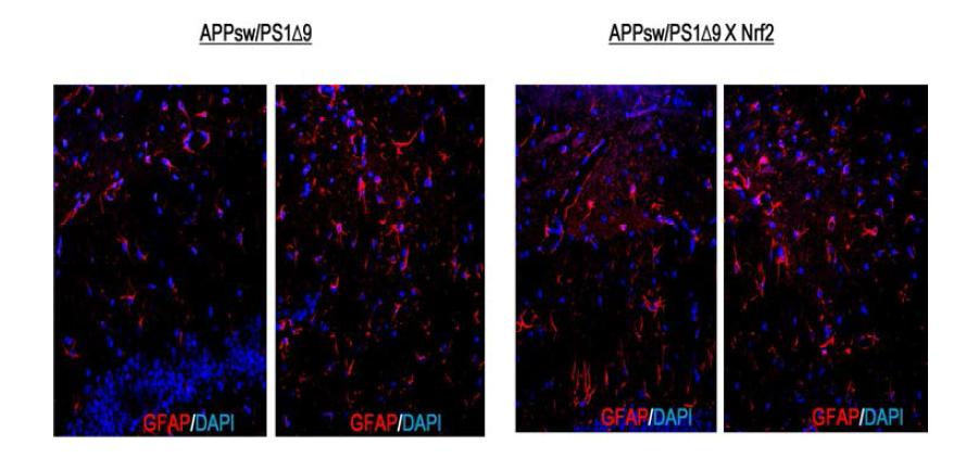 Comparison of activated astrocytes in cortexes