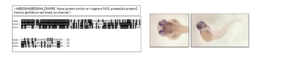 SMART 분석을 통한 zebrafish plp2와 human plp2와의 시컨스 homology 비교(왼쪽). 유전자 발현양상(오른쪽)