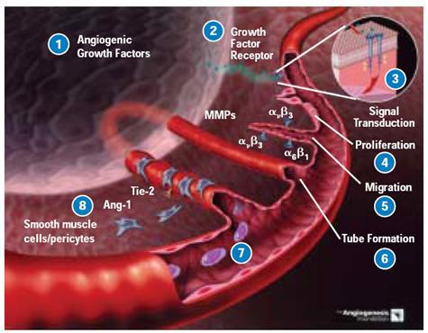 신생혈관형성 과정