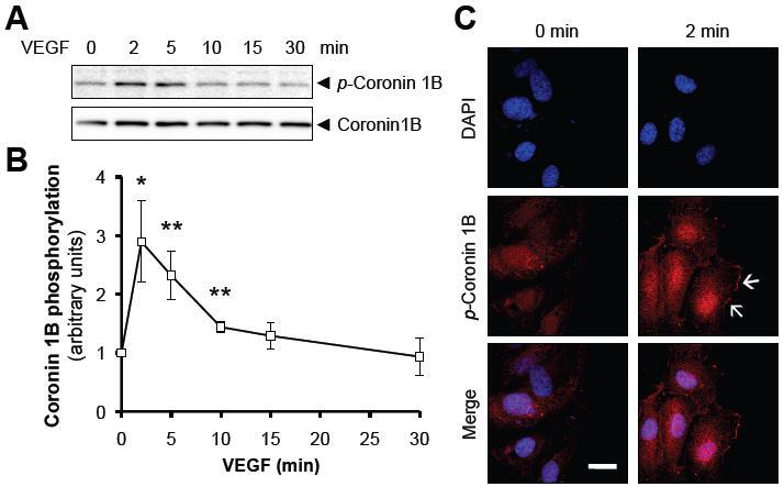 VEGF에 의한 coronin1B serine 2 인산화