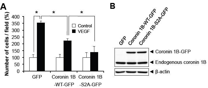 VEGF에 의한 혈관내피세포 이동성 증가에서의 coronin 1B serine 2 인산화의 중요성