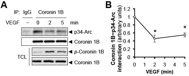 VEGF에 의한 coronin1B-Arp2/3 complex 결합 억제