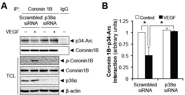 p38α에 의한 coronin1B serine 2 인산화와 coronin1B-Arp2/3 coplex 결합과의 관계