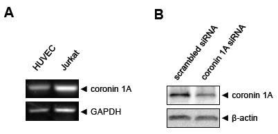 혈관내피세포에서의 coronin1A mRNA 발현(A) 및 coronin1A siRNA에 의한 단백질 발현 억제(B)