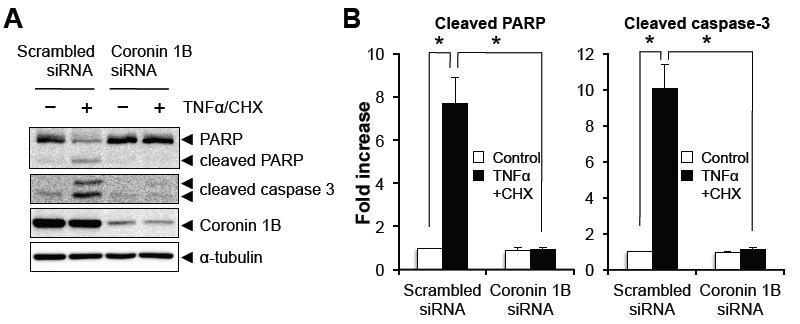 Coroin1B 발현 억제에 의한 세포 사멸 유도 단백질 활성 저해