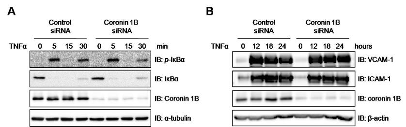 Coronin1B 발현 억제와 TNFα에 의한 혈관 염증관련 단백질 발현 양상
